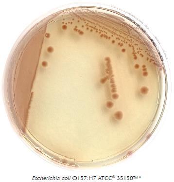 coli lehetséges patogének amik előfordulhatnak ivóvízben, medencevízben és vízművek kilépő vizében. Liofilchem Coli Coliform agar Szelektív kromogénes tápközeg E.