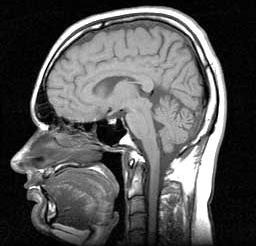 MRI, Nuclear Magnetic Resonance Imaging Mágneses Magrezonancia Képalkotás orvosi diagnosztikában