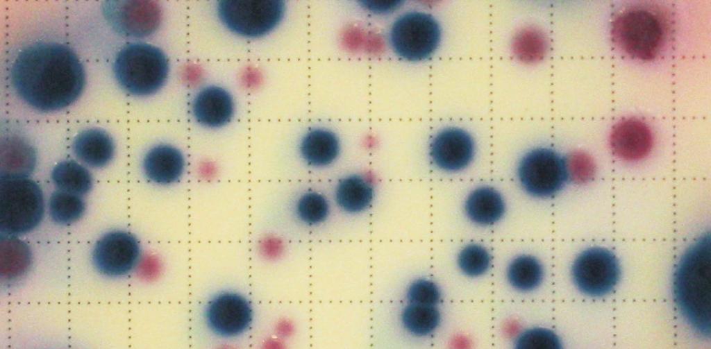3. User friendly software which allows launching of the measurement in a few simple steps, and results are provided to the microbiologist performing the analysis in the form of an easy to overview,