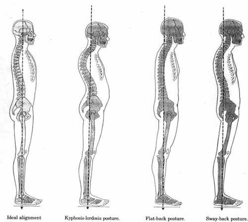 STUDY-All gain, no pain muscular effort to hold the posture are minimal (20) When in a neutral posture (good posture), the body is in its strongest and most balanced and the least strain is placed on
