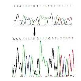 A CaSR génhiba a genetikai eltérés mechanizmusa CaSR gén 6-os exonjának szekvencia