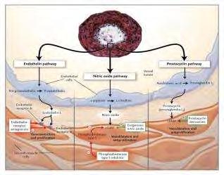 DU RAYNAUD SY(digital ulcer) SZISZTÉMÁS SCLEROSIS-ban THERAPIÁS LEHETŐSÉGEK o CCB o ARB, ACEi o Alfa blockolók o PDE5 inhibítorok o Prostacyclin analódok o ER antagonisták o Nitrátok o