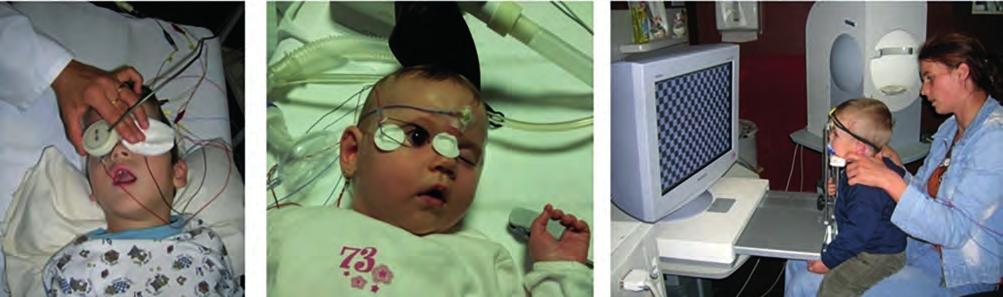 Electrophysiological methods in diagnostics of visual diseases 11. ábra: Csecsemők és kisgyermekek vizsgálata.