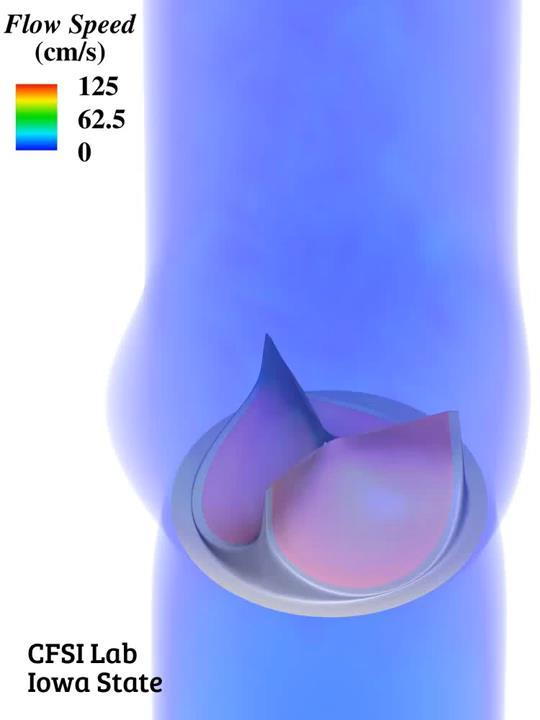 Fluid Structure Interaction (FSI) Hsu, MC., Kamensky, D.