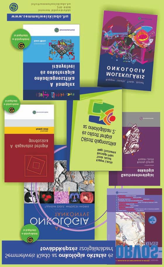 KORSZERÛ ISMERETEK A SZEMÉSZETBEN mészeti tünetek jellemzik. Kétoldali rekurráló, kezdetben elülsõ, késõbb hátsó szegment érintettség (retinalis vasculitis) is kialalkul (4).