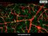 Mikroglia. Photo: NIH, retina