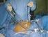Az endometriosis korszerű laparoszkópos sebészi kezelése