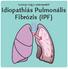 Ismerje meg a szervezetét! Idiopathiás Pulmonális Fibrózis (IPF)