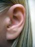 Fülmögötti hallókészülék