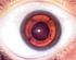 A szem elülső szegmentumának műszeres vizsgálati lehetőségei