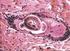 Trichinella spiralis (1)