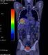 PET/CT vizsgálatok szervezési sajátosságai