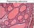 Az endometrium és a pajzsmirigy daganatainak claudin expressziója: beszélhetünk-e e szervek papilláris daganatainak közös markerérıl? Dr.
