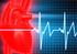 Stabil angina pectoris diagnózisa és kezelése