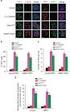 A Telomerase-specific Doxorubicin-releasing Molecular Beacon for Cancer Theranostics